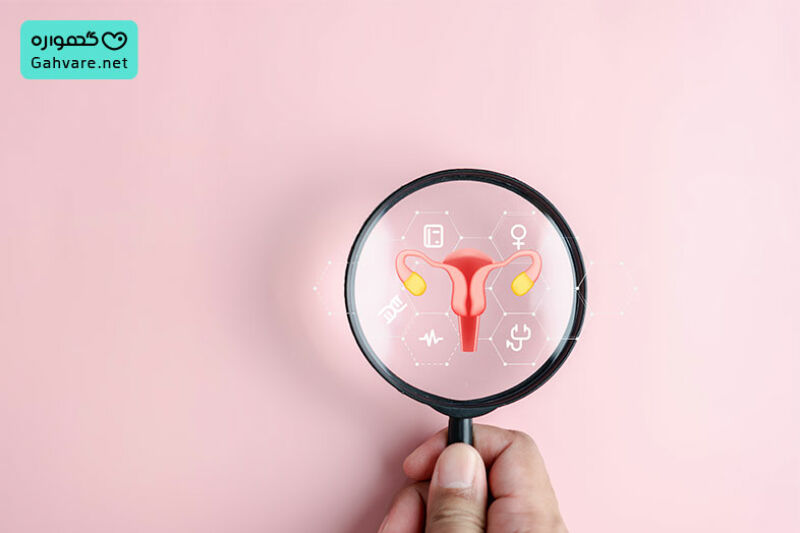 پیشگیری از حاملگی خارج از رحم