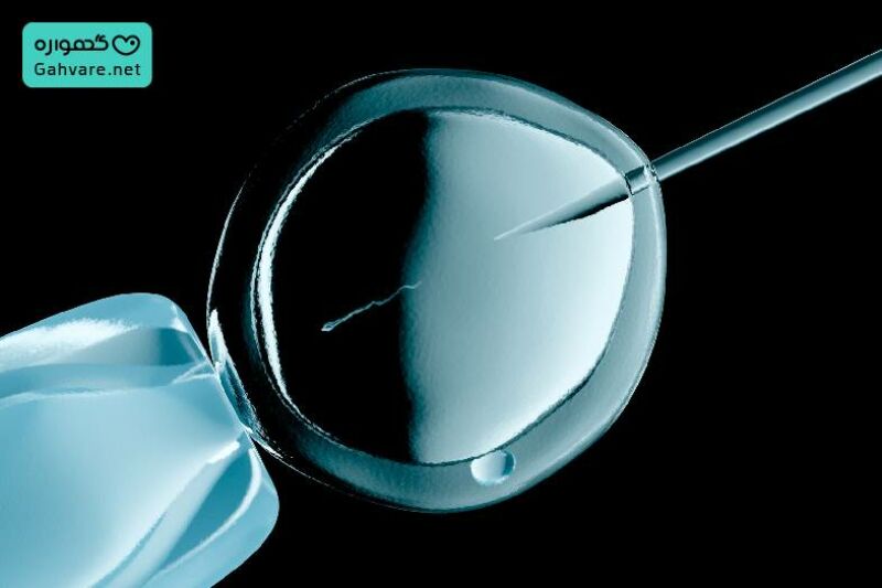 تعیین جنسیت جنین با آی وی اف