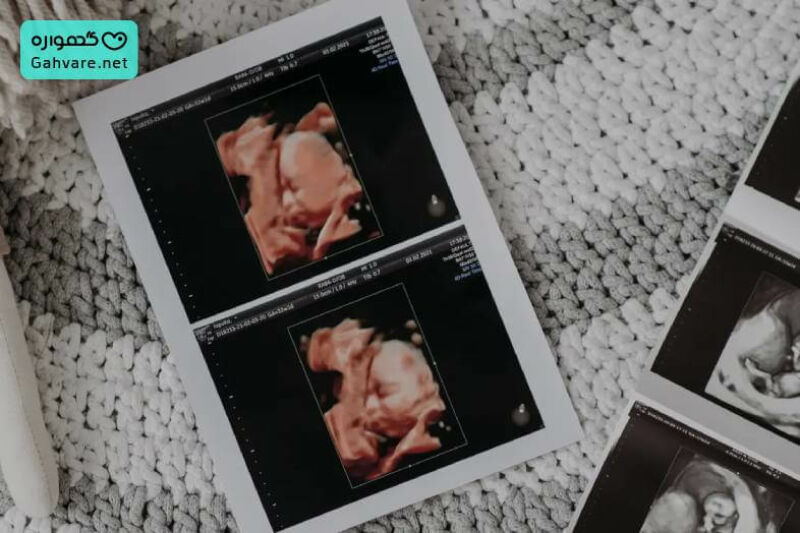 عوارض تعیین جنسیت با آی وی اف