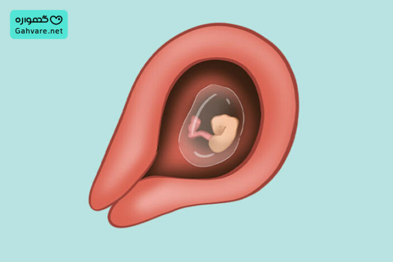 خطرات احتمالی و مراقبت های هفته پنجم بارداری