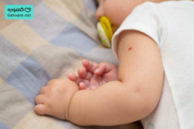 مراقبت بعد از واکسن دو ماهگی