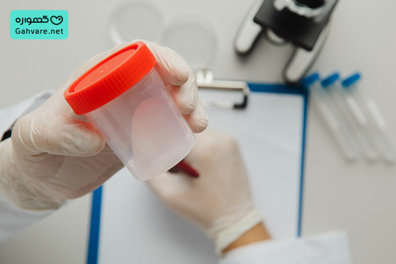 تکنیک برای زنده ماندن اسپرم