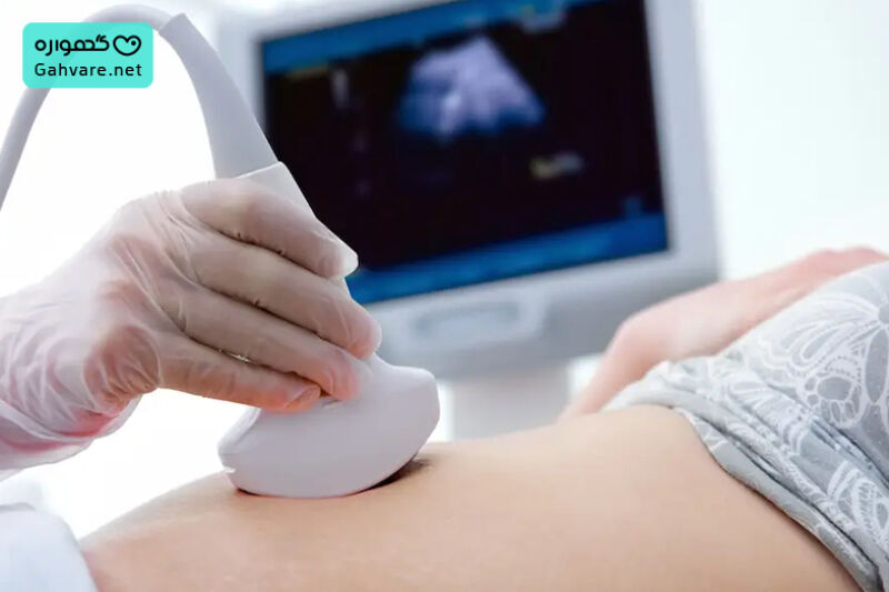 راه های تشخیص بارداری پوچ