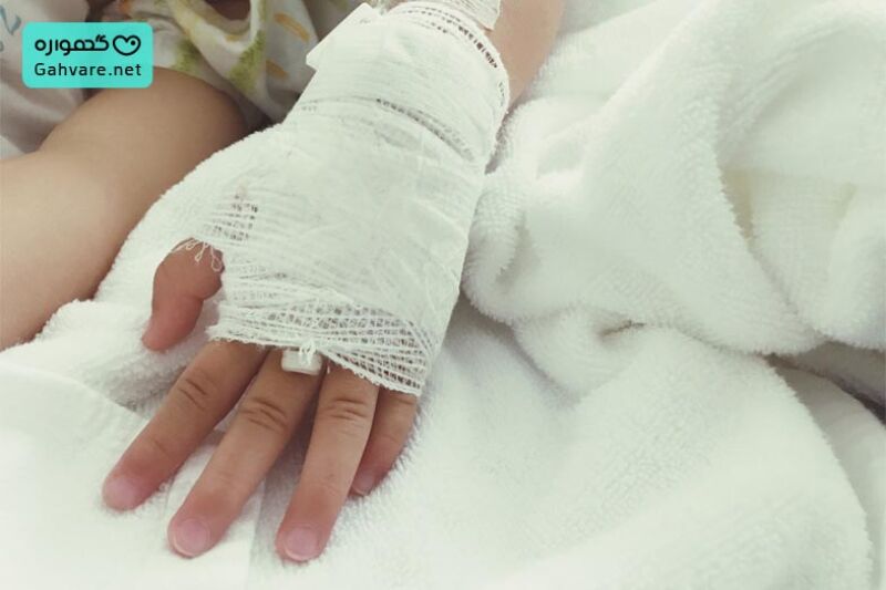 دستان کودکی با پانسمان