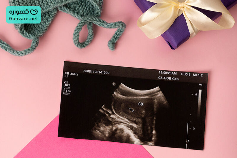 جنین در هفته 16 بارداری