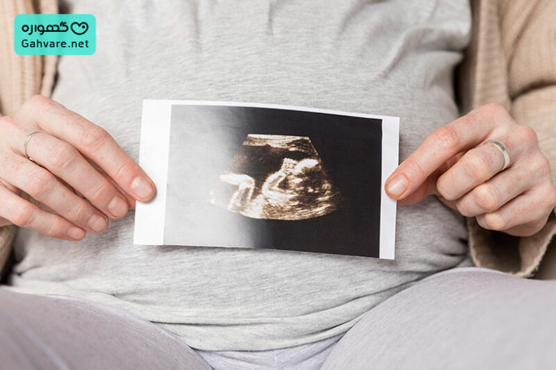 تغییرات مادر در هفته 17 بارداری