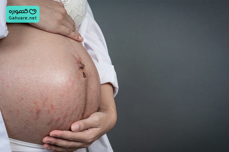 تغییرات مادر در هفته 19 بارداری