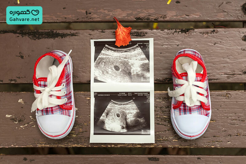 تغییرت جنین در هفته 22 بارداری
