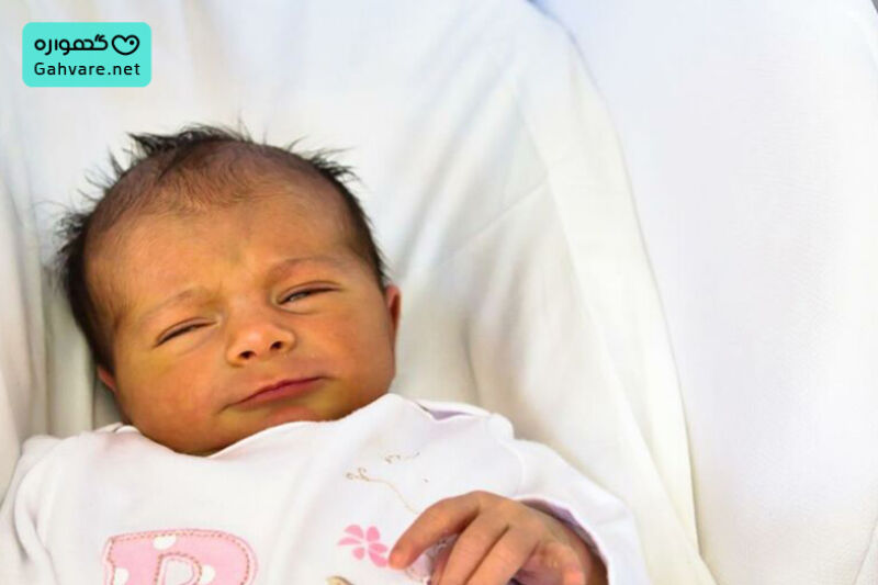 زردی نوزاد از شیر مادر