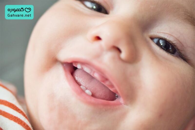 صورت بچه ای تازه دندان دراورده