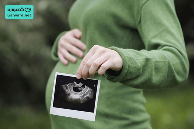 سونوگرافی تعیین جنسیت در هفته چندم انجام می&zwnj;شود؟
