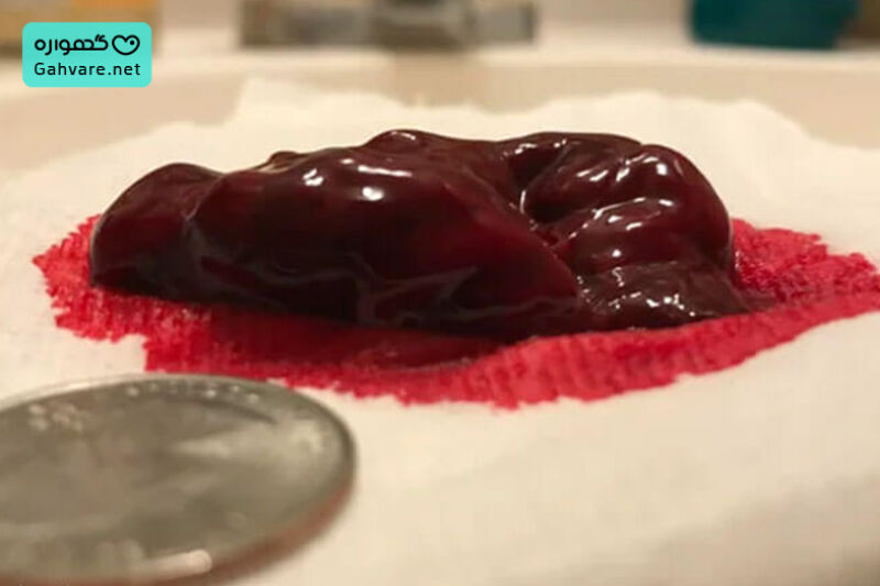 لخته خون شبیه جگر در پریودی