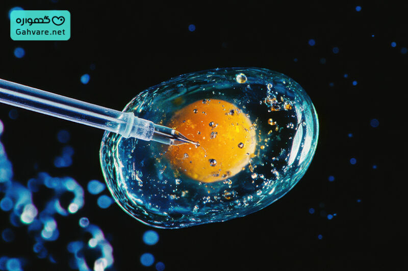 نقش سن در انتخاب بین IUI و IVF