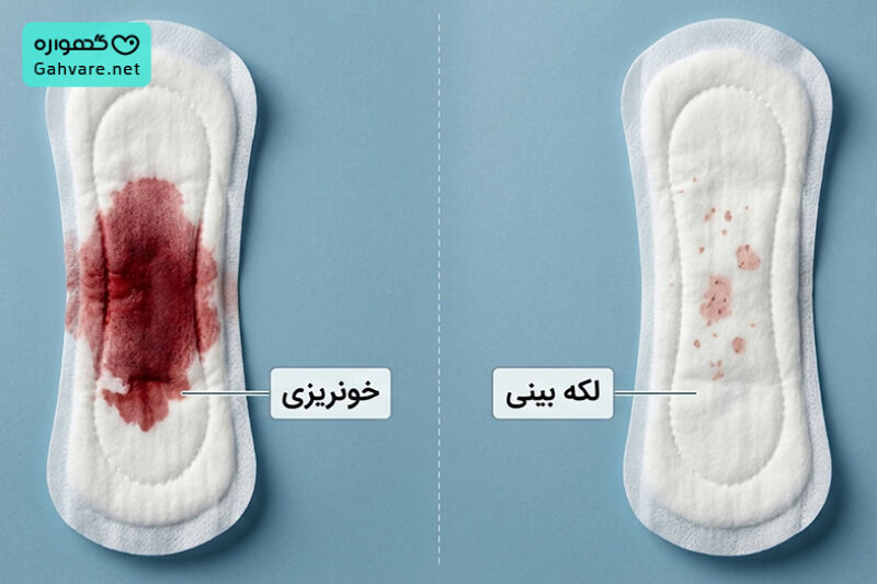 میزان طبیعی خونریزی در بارداری