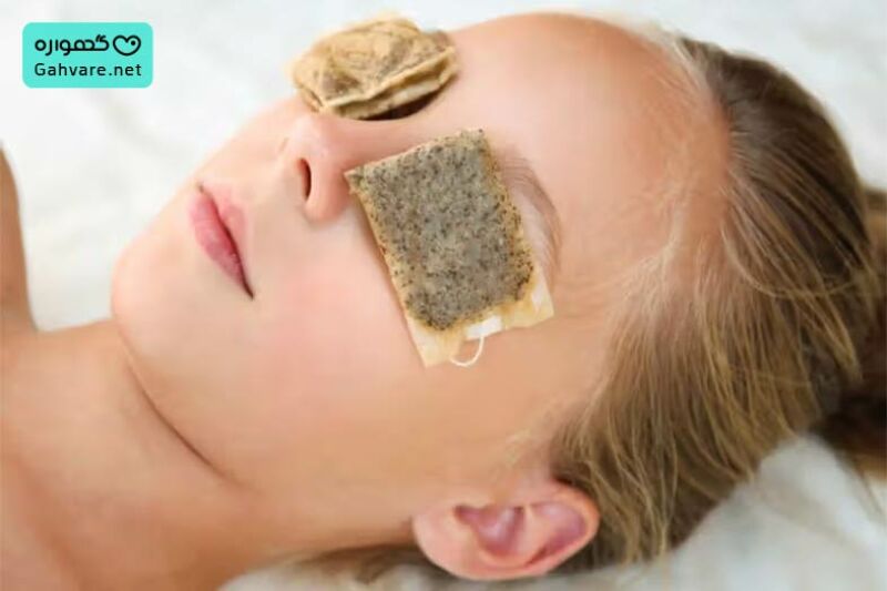 استفاده از چای کیسه&zwnj;ای برای درمان سیاهی زیر چشم در بارداری