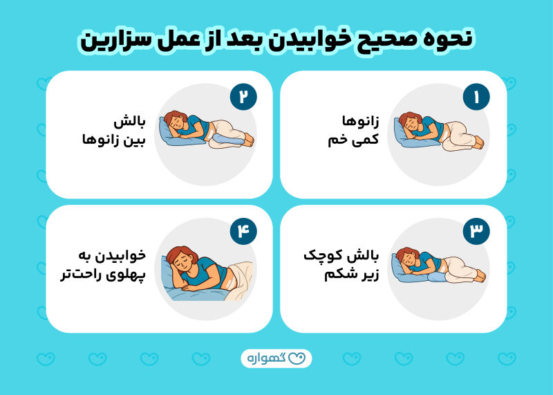 نحوه صحیح خوابیدن بعد از سزارین