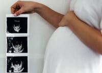 تفاوت جنین دختر و پسر در سونوگرافی هفته ۱۲