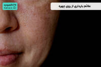 علائم بارداری از روی چهره