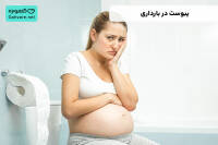 یبوست در بارداری
