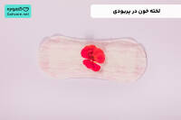 لخته خون در پریودی