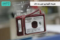 هزینه نگهداری خون بند ناف