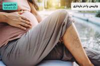 واریس پا در بارداری