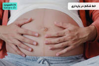 خط شکم در بارداری