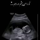 آواتار مامان هامین🤱🏻